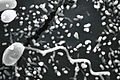 Microsporidian spore (Microsporidia)