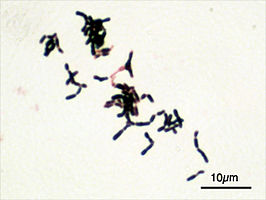 Bifidobacterium