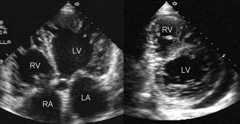 File:LVNC3.jpg