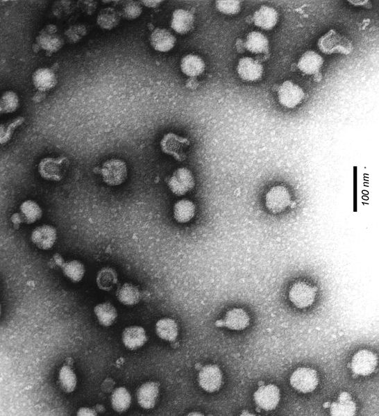 File:Semliki-Forest-Virus.jpg