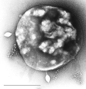 Sulfolobus sp. infectada com o vírus STSV-1