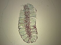 Pinus (den): mannelijke strobilus met groot aantal microsporofyllen en microsporangia.