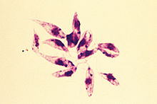 Leishmania tropica 7.jpg