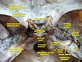 Trommehola, canalis facialis og den indre halsarterien.