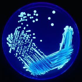 Legionella sp. sob iluminação ultravioleta