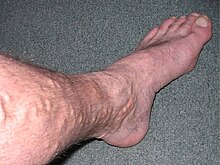 Leg Before 1.jpg