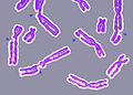 An image of multiple chromosomes (some are incomplete as they are damaged)