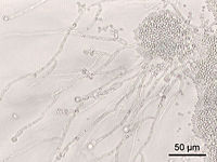 Candida albicans 200-kordse suurendusega