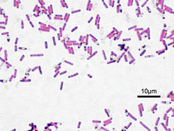 Bacillus subtilis teñidos.