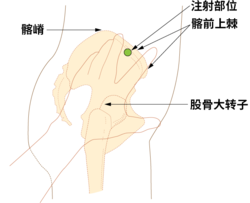 股臀肌注射区域