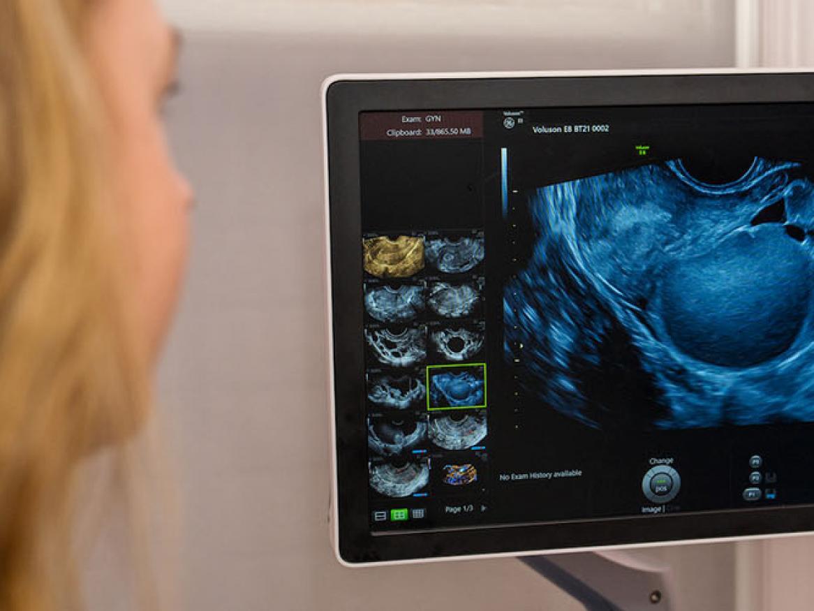 A doctor analysing an ultrasound image