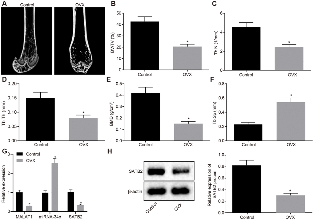 Characterization of the OVX mouse model. (A) Three-dimensional CT image of distal femur (1 mm). (B–F) Quantitative data of BV/TV (B), Tb.N (C), Tb.Th (D), BMD (E) and Tb.Sp (F) in distal femoral of mice. (G) The MALAT1 and miR-34c expression as well as the mRNA expression of SATB2 in femoral tissues evaluated by RT-qPCR. (H) The protein expression of SATB2 in femoral tissues evaluated by Western blot analysis. * p vs. control mice. Data were expressed with mean ± standard deviation. In Panel B–F, the unpaired t test was used for data analysis.