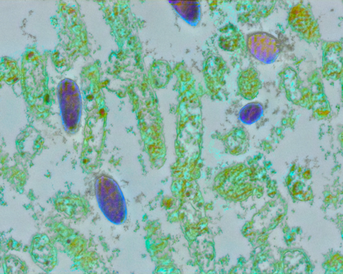 Lactobacillus iners after treatment with oleic acid