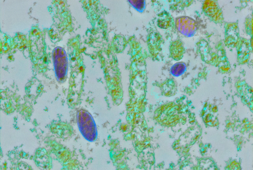 Lactobacillus iners after treatment with oleic acid