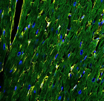 The human heart has a diversity of cell types, including cardiomyocytes (green) and fibroblasts (yellow). DNA is stained blue.