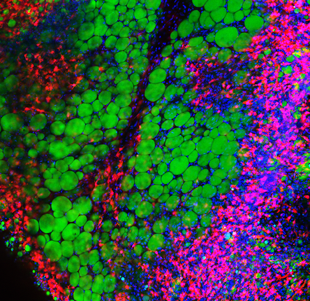 Obesity - cells