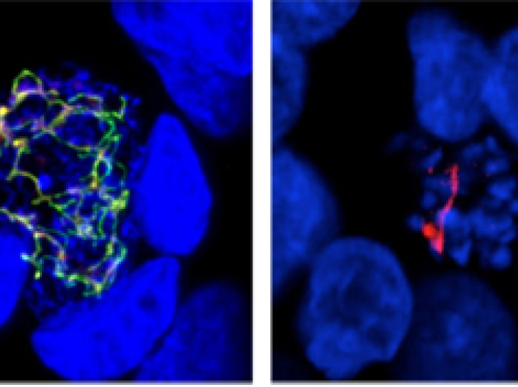 Malaria and toxoplasmosis have an Achilles heel from plants