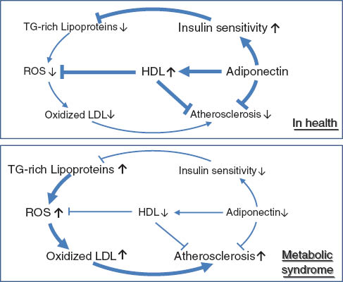 Figure 1 Schematic diagram of the effects of adiponectin and oxidative stress on circulating lipoproteins and atherosclerosis under healthy conditions and in metabolic syndrome.In metabolic syndrome, the reduction of adiponectin leads to the increase of TG-rich remnant lipoproteins via decreased insulin sensitivity, which contributes to generation of ROS, resulting in the oxidation of LDL that accelerates the development of atherosclerosis. Moreover, the anti-atherosclerosis force is ameliorated directly by the reduction of adiponectin and indirectly through the decrease of HDL that contributes to reverse cholesterol transport and suppresses the oxidation of LDL.