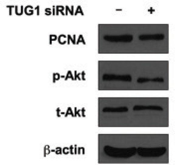 Figure 3 Knockdown of TUG1 reduces survival markers in vitro. U2OS cells were transfected with control siRNA or lncRNA TUG1 siRNA. Forty-eight hours later, cells were harvested for western blotting. Protein level of PCNA, p-Akt (S473) and t-Akt were tested. β-actin was used as the loading control in western blotting. The results showed that inhibited expression of TUG1 suppressed cell proliferation marker PCNA, and also suppressed cell survival marker p-Akt.