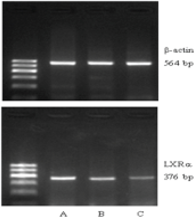 Figure 1 LXRa mRNA expression in placentas of each group (A: severe PE, B: mild PE, C: normal)