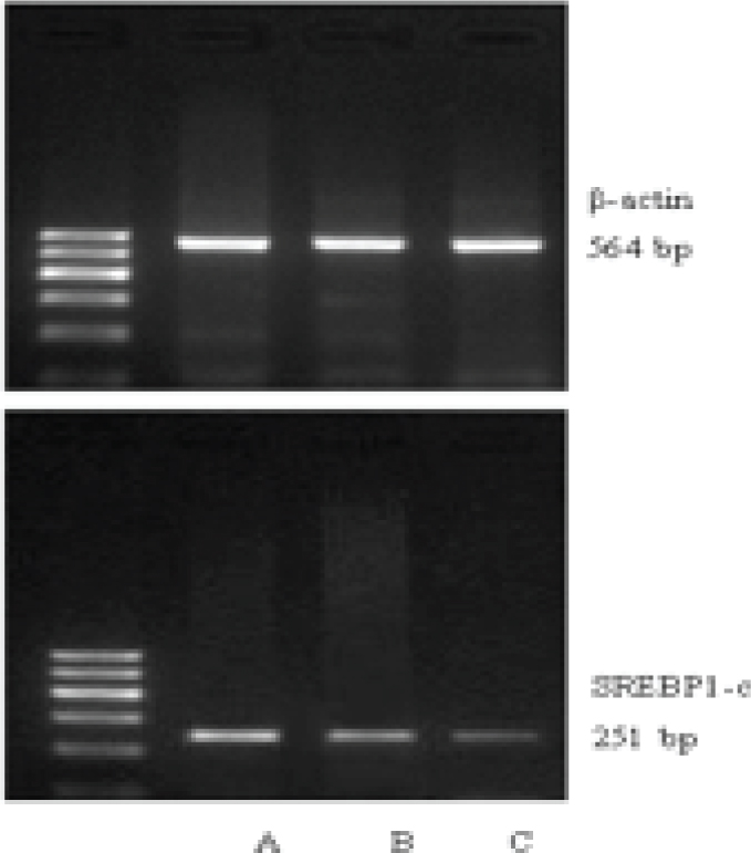 Figure 2 SREBP-1c mRNA expression in placentas of each group (A: severe PE, B: mild PE, C: normal)