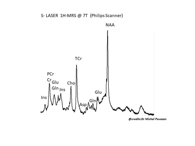 Spectroscopy billede 1