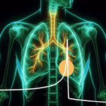 Tumor ion therapy