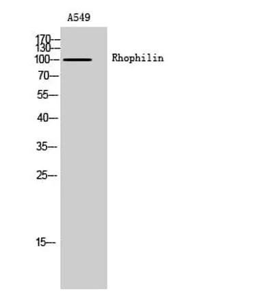 Antibodie to-RHPN1 