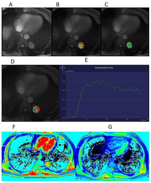 J Cancer Image