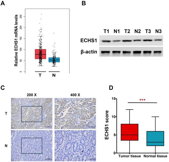 J Cancer Image