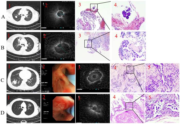 J Cancer Image