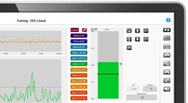 BioTrace+ Software for biofeedback, neurofeedback, qEEG and research