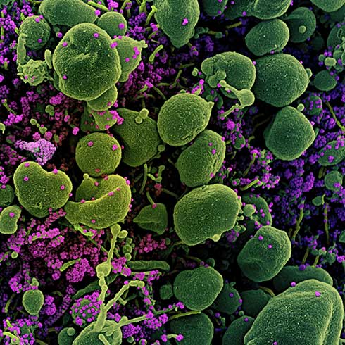 COVID-19 新型コロナウイルス