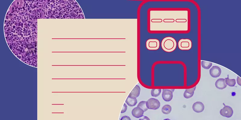 Illustration shows a breathalyzer device with a paper report and microscope slides. 