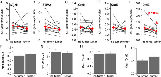 Gene expression of STIM1, STIM2, Orai1, Orai2 and Orai3 in healthy and tumorous human prostate tissue.