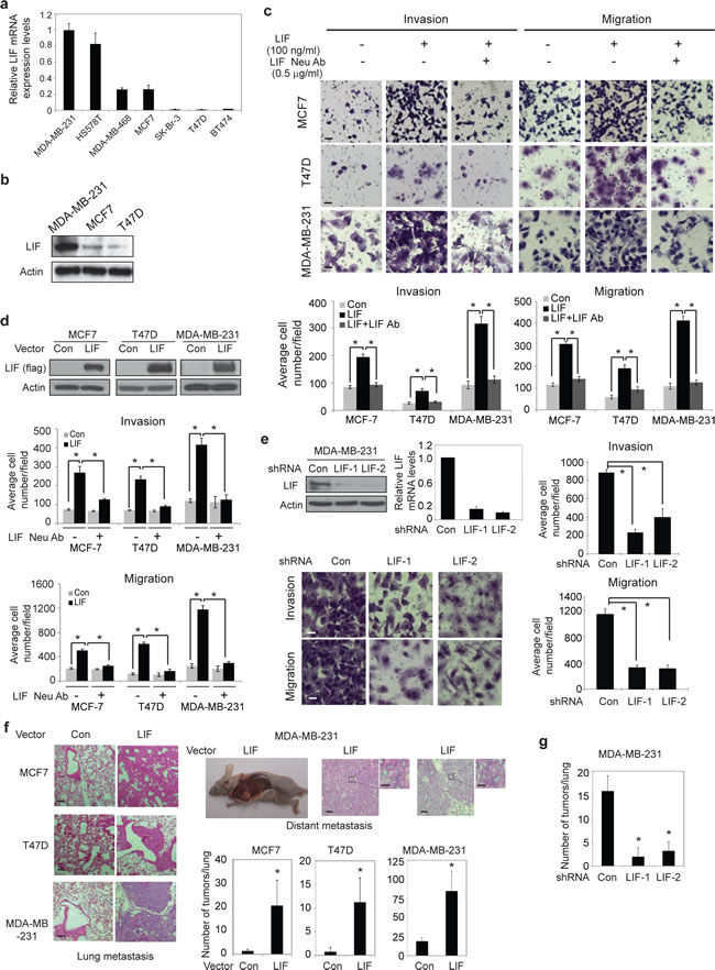 LIF promotes metastasis of breast cancer cells.