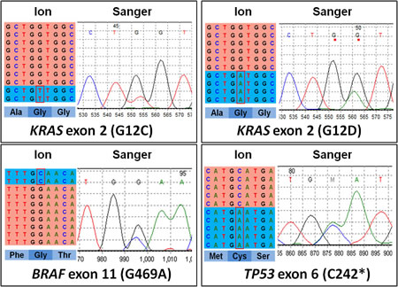 Representative examples of validation by Sanger sequencing of mutations identified using next generation sequencing.