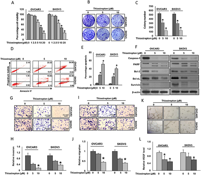 Effect of thiostrepton on cell viability, apoptosis, invasion, migration and angiogenesis.