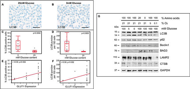 Glucose depletion is a more potent inducer of ALP than hypoxia in glioma cells.