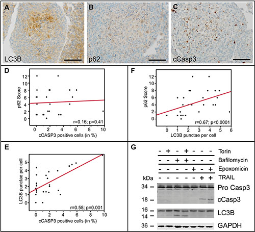 Autophago-lysosomal and apoptotic pathways are independently induced in glioma cells.