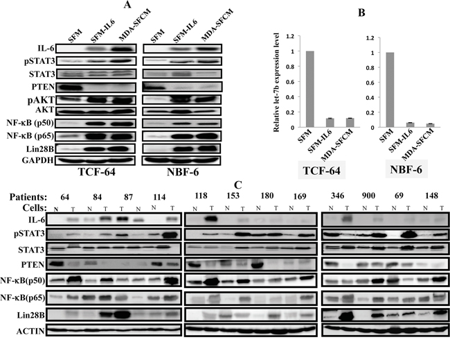 The IL-6/STAT3/NF-&#x03BA;B autocrine positive feedback loop is active in activated fibroblasts in vitro and in tumors.