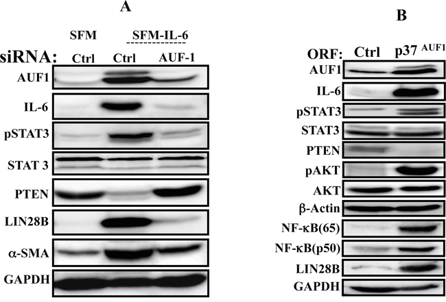 AUF1 is part of the IL-6/STAT3/NF-&#x03BA;B autocrine positive feedback loop.