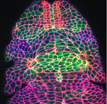 renal organoid