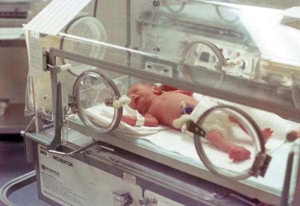 A premature baby in a neonatal incubator.