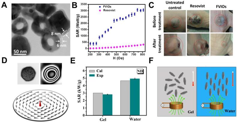 Theranostics Image