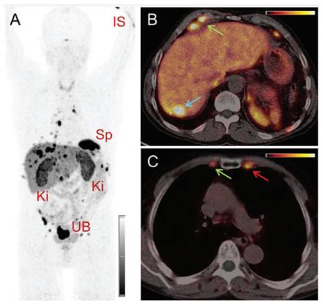 Theranostics Image