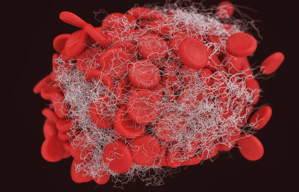 Hematology / Hemostasis