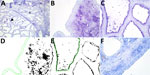 Results of staining showing wide expression of the duck receptor for influenza A virus (designated MAA-II) in the alveoli of the bovine mammary gland. A) An example of the MAA-II staining of a mammary gland from a cow in late lactation. Arrowhead indicates expression of the duck receptor in active alveoli. Asterisks indicate less staining in the less active alveoli. Original magnification ×10. B, C) MAA-II staining of a duct (B) and an alveolus (C) in a 3-year-old cow. Original magnification ×60. D, E) Positive staining obtained from the image analysis. Green line shows the region of interest. Original magnification ×60. F) A neuraminidase pretreatment negative control showed markedly reduced staining of the MAA-II lectin in the alveolus but some nonspecific staining in the duct epithelium. The staining was visualized using Vector Blue (Vector Laboratories, https://vectorlabs.com). Original magnification ×60.